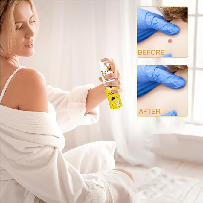 Tag Recede: El Spray Natural que Elimina Verrugas y Etiquetas Sin Dolor