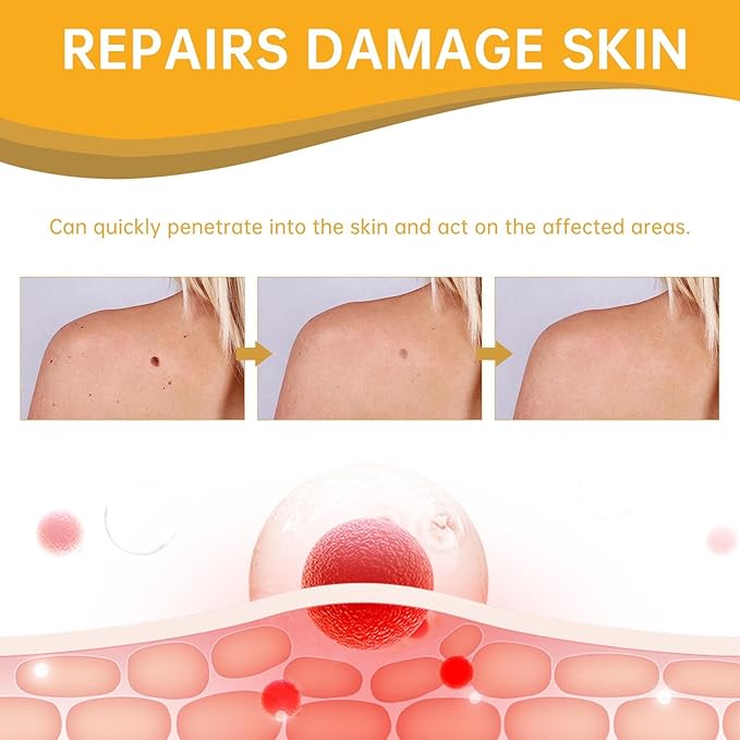 Tag Recede: El Spray Natural que Elimina Verrugas y Etiquetas Sin Dolor